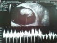 /album/mundo-ecografico/a2011-11-24-09-37-27-jpg/